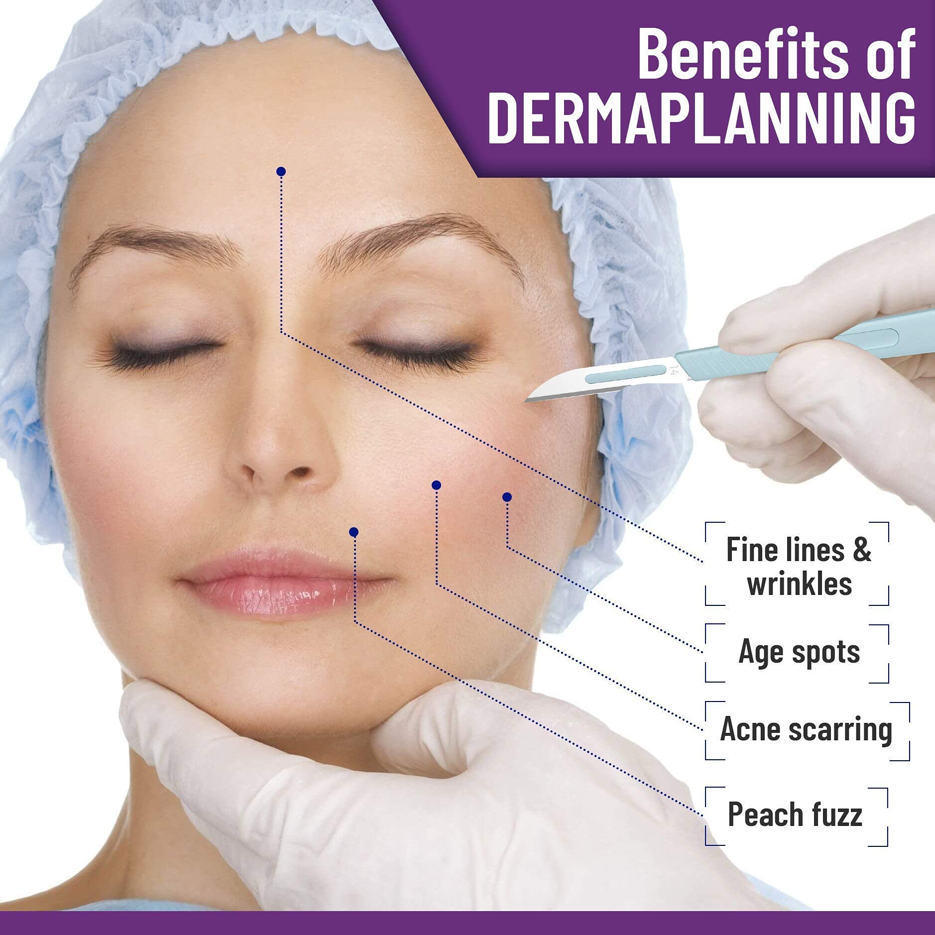 Disposable Scalpel 10, Pack of 20 Disposable Dermaplaning Blades with Plastic Handle and Disposable Scalpel 14, Pack of 20 Disposable Dermaplaning Blades - Image 4