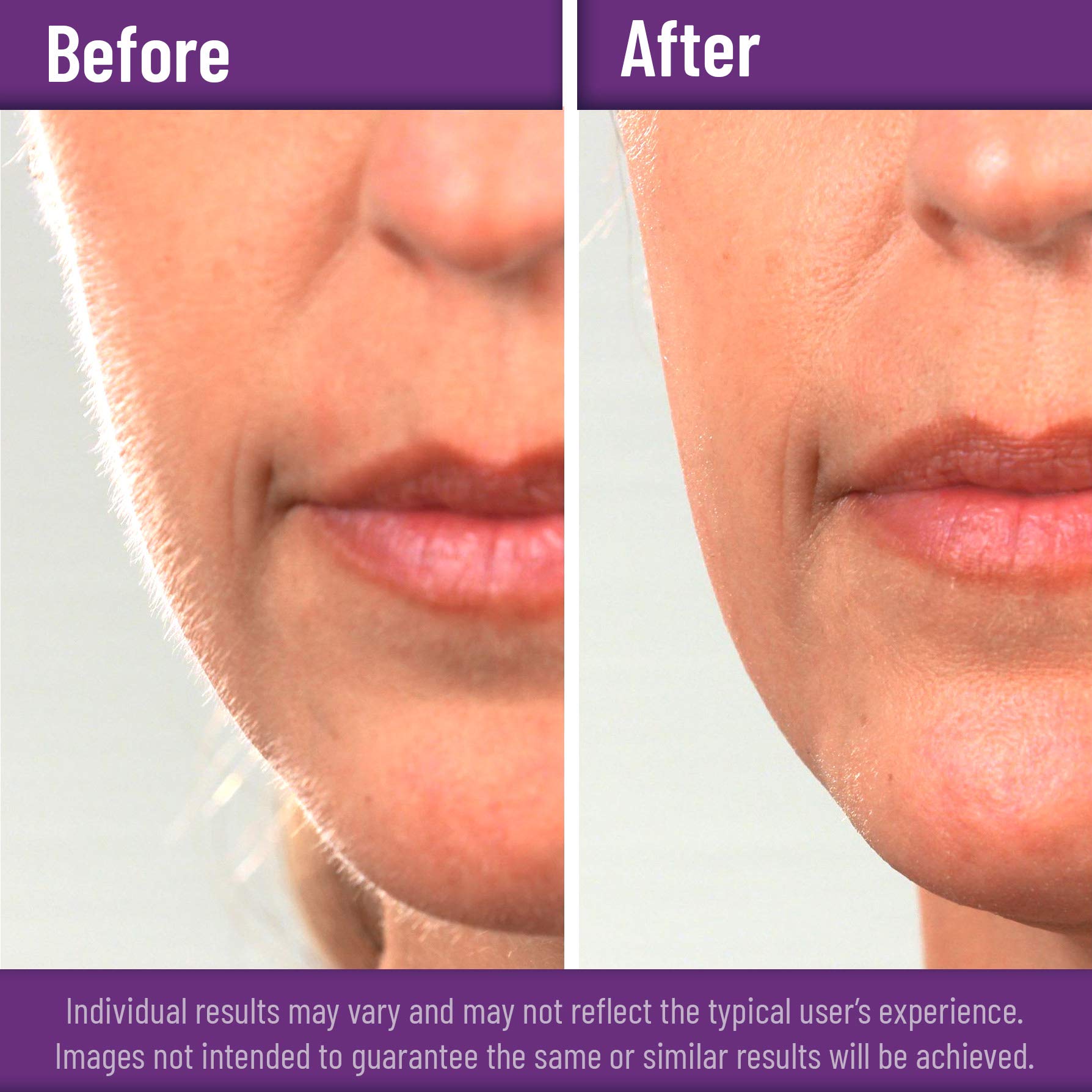 Disposable Scalpel Blades with Metal Handle, Dermaplaning Tool for Face Professional, Scalpel Knife for Mycology, dermaplaning Blades, Surgical scalpels, Non-Slip & Reusable Scalpel Handle. - Image 7